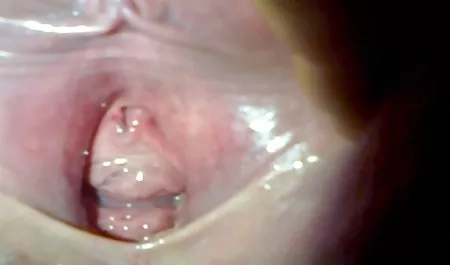 વિકૃત કુટુંબ - જાંબલી વરસાદ - વિડિઓ ચશ્મા વાહિયાત વાહિયાત Striptease